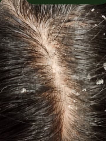 Scalp Defense Serum — sebelum pemakaian