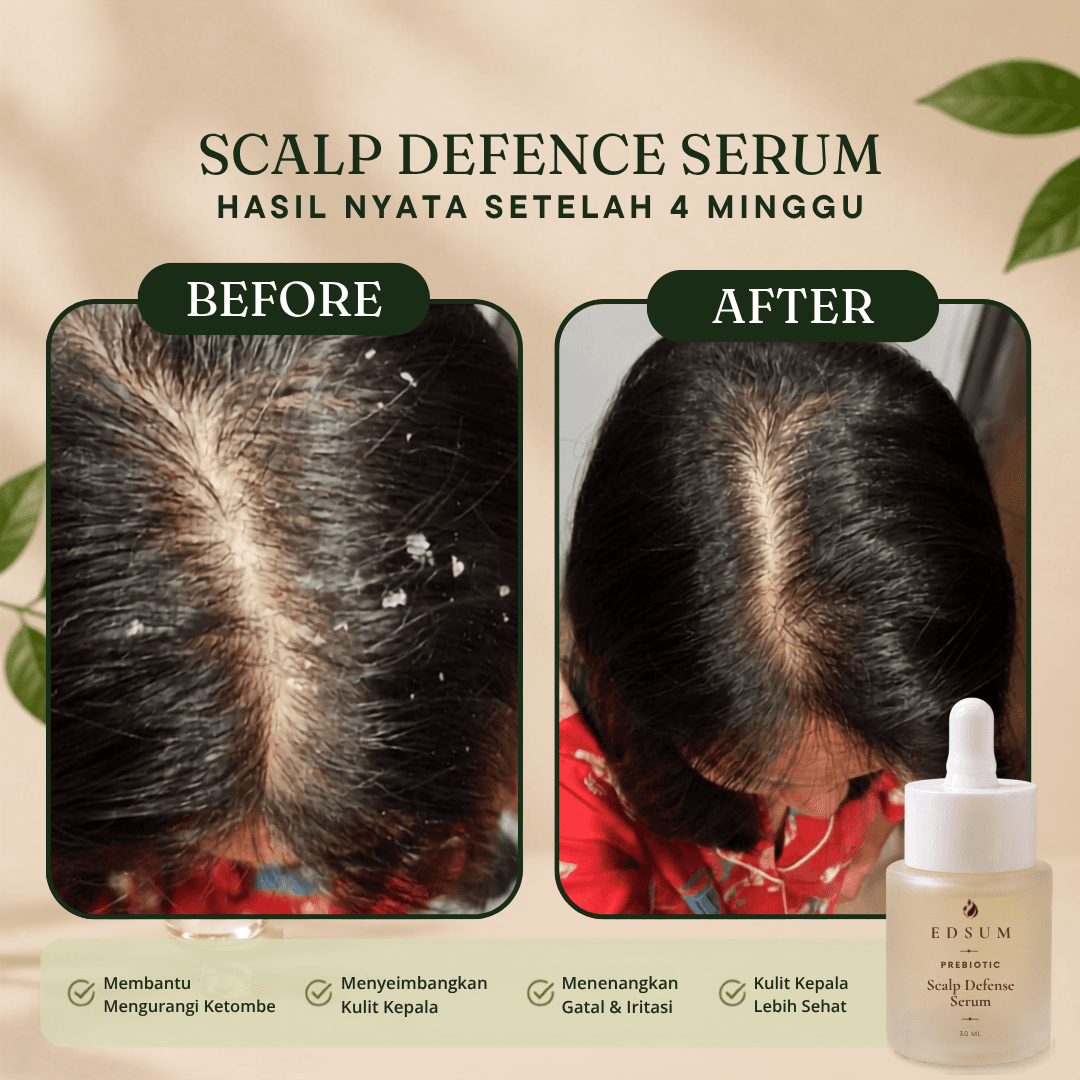 Hasil pemakaian Scalp Defense Serum